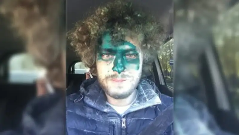 Блогера Варламова второй раз за день облили зелёнкой