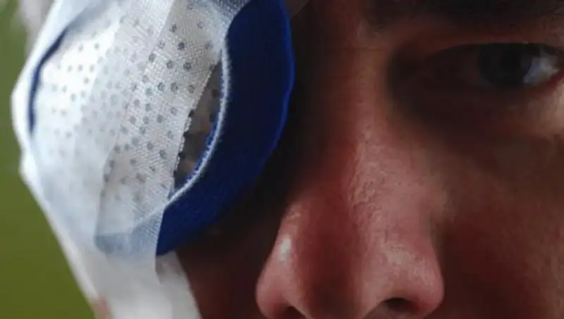 Что нужно знать о кровоизлиянии в стекловидное тело глаза