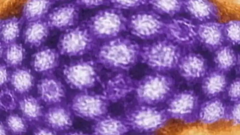 Около 200 человек заразились норовирусом после посещения казино