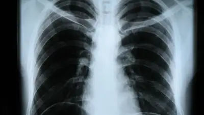 wikipedia, фото - Новости Zakon.kz от 02.07.2020 16:49