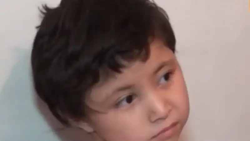 В Шымкенте девочка осталось парализованной после нападения на нее барана