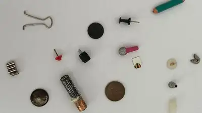 инородные предметы в желудке, фото - Новости Zakon.kz от 13.07.2023 21:32