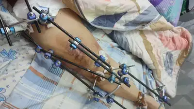 Карагандинка обвиняет врачей в халатности , фото - Новости Zakon.kz от 09.06.2023 18:19