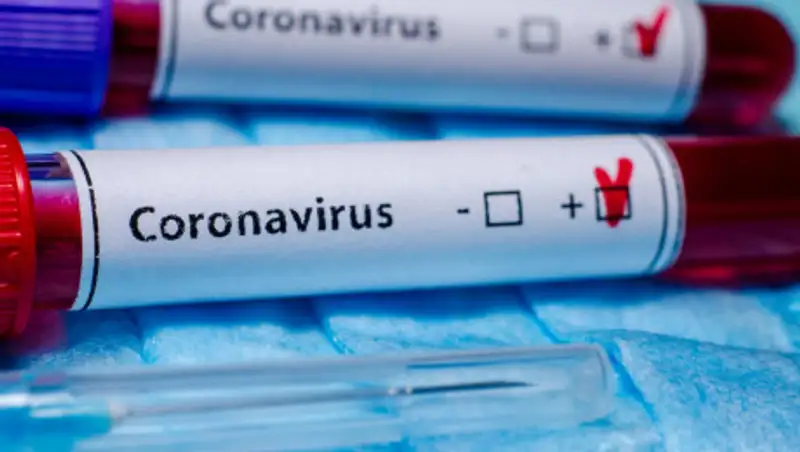 Еще 47 казахстанцев заразились коронавирусной инфекцией