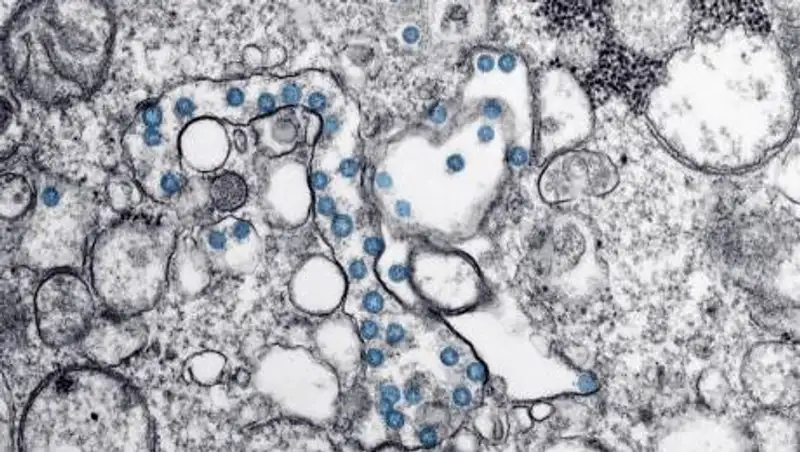 В кишечнике человека нашли десятки тысяч неизвестных науке вирусов