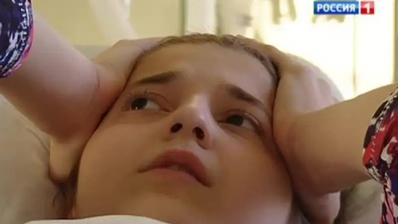 Известная российская сиамская близняшка Зита попала в реанимацию