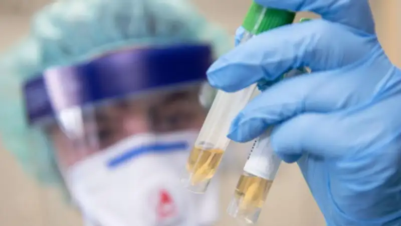 Число заболевших коронавирусом в мире превысило 800 тысяч