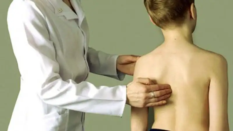 Как плохая осанка влияет на зрение ребенка