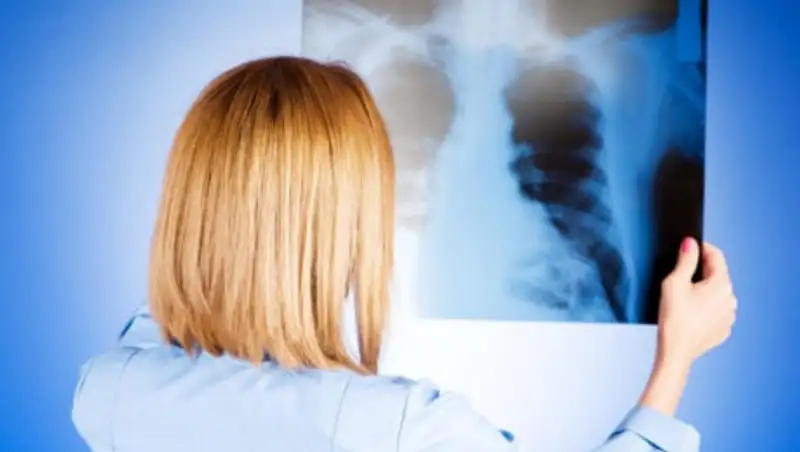 571 случай коронавирусной пневмонии выявили в Казахстане за сутки