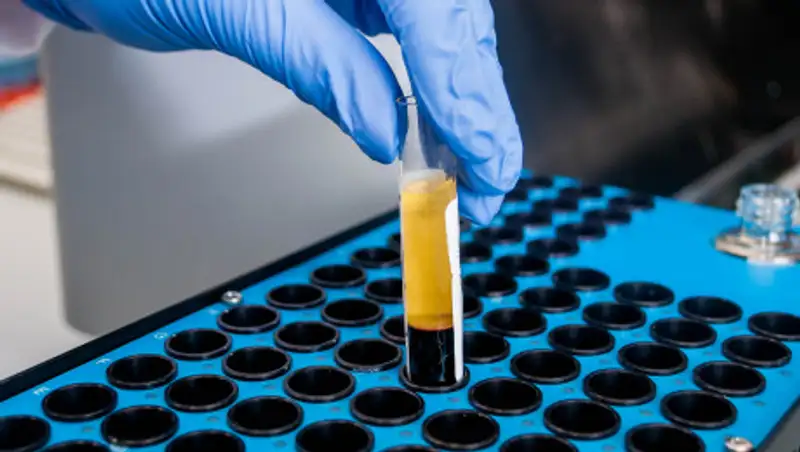 В Китае второй человек умер от нового типа короновируса