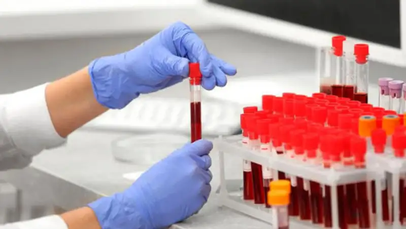 В Казахстане 108 человек выздоровели от коронавируса