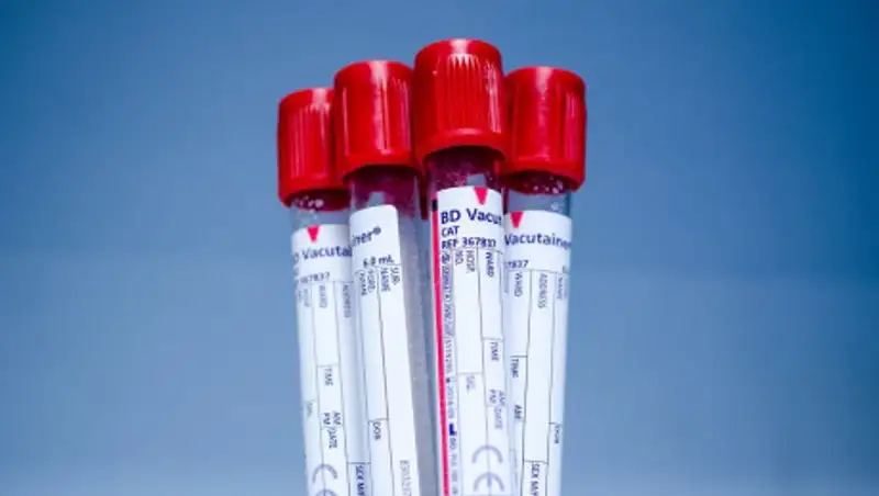 Зависит ли тяжесть COVID-19 от группы крови