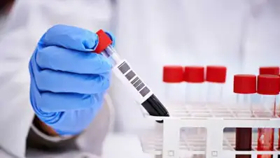 pixabay.com, фото - Новости Zakon.kz от 21.05.2020 14:16