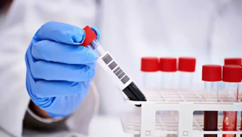 Еще 43 человека выздоровели от коронавируса в Казахстане