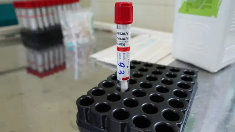 Биртанов объяснил необходимость сдавать анализ на COVID-19 после экспресс-тестов