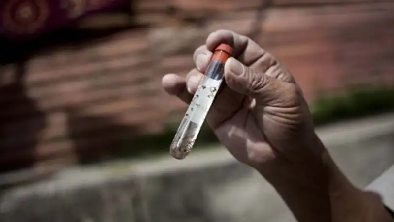 Ученые подтвердили связь вируса Зика с микроцефалией у младенцев