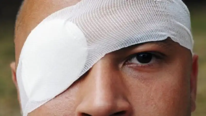 Интересные факты о травме глаза