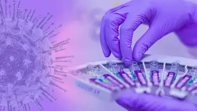 pixabay, фото - Новости Zakon.kz от 31.08.2021 08:01