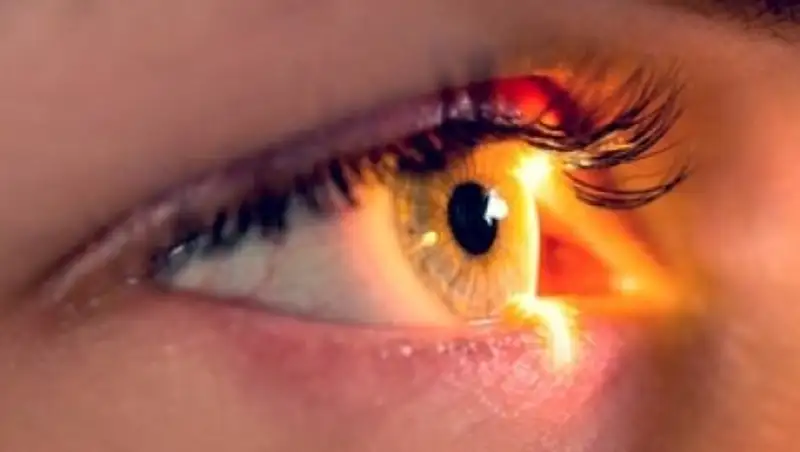 Чем опасна пигментная абиотрофия сетчатки для зрения