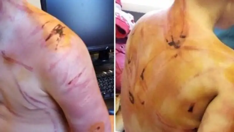 Отчим двое суток истязал четырехлетнюю падчерицу