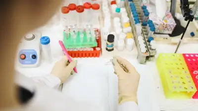 Врач-эпидемиолог рассказала, как избежать заражения ВИЧ, фото - Новости Zakon.kz от 02.12.2022 15:16