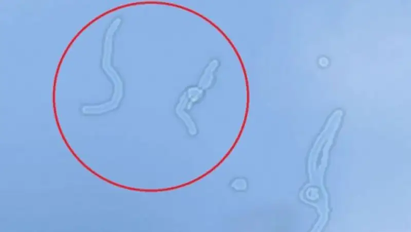 Откуда появляются "мушки" перед глазами