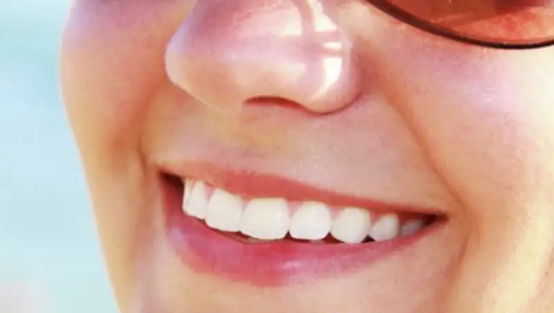 Американка после исправления прикуса проснулась с британским акцентом