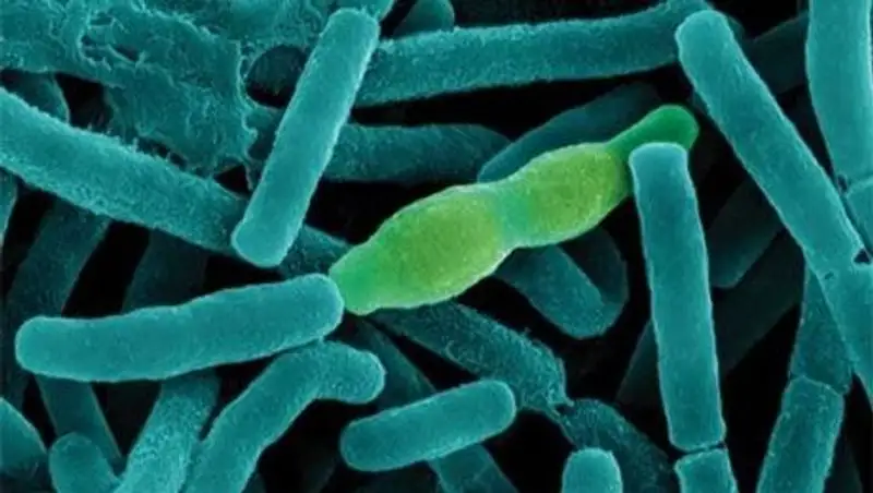 В Алматинской области двух мужчин госпитализировали с подозрением на сибирскую язву 