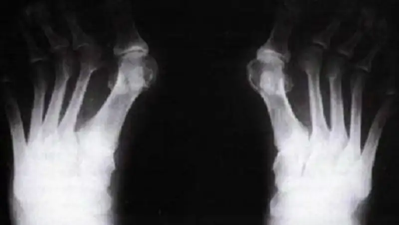 В Костанайской области женщина получила 50 тысяч тенге за отрезанный палец 