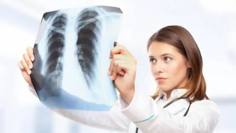 174 казахстанца заболели пневмонией за сутки