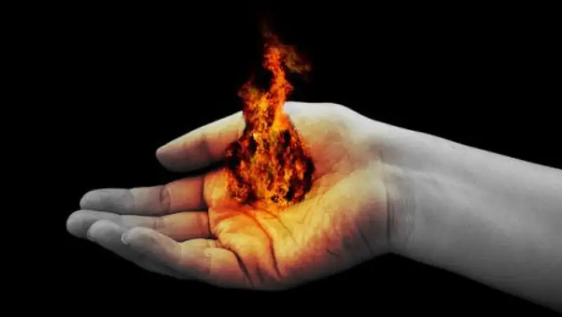 В Таразе дети подожгли 6-летнего мальчика