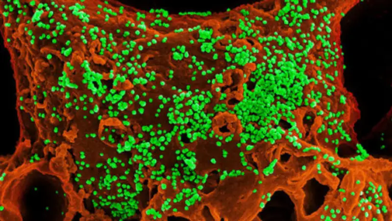 Еще 2 млрд тенге выделят на борьбу с коронавирусом