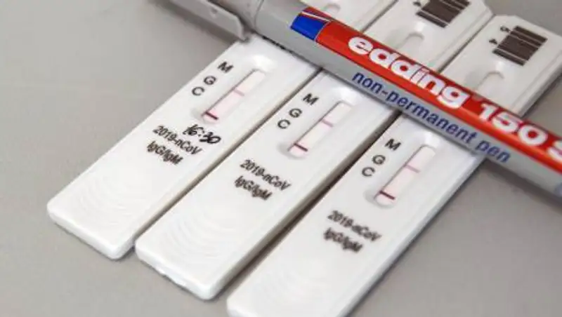 Новые данные: сколько сохраняются антитела к коронавирусу