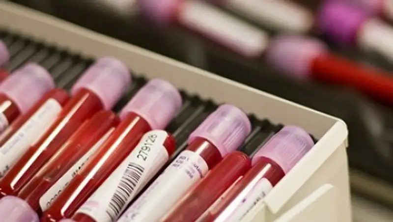 Определена самая смертоносная группа крови человека