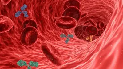 pixabay, фото - Новости Zakon.kz от 08.09.2021 07:39