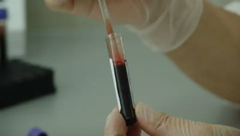 Продажа тестов в онлайн объявлениях незаконна — Биртанов