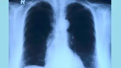 pixabay.com, фото - Новости Zakon.kz от 07.09.2020 12:27