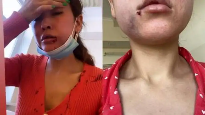 Избил жену на улице – полиция Туркестанской области начала расследование