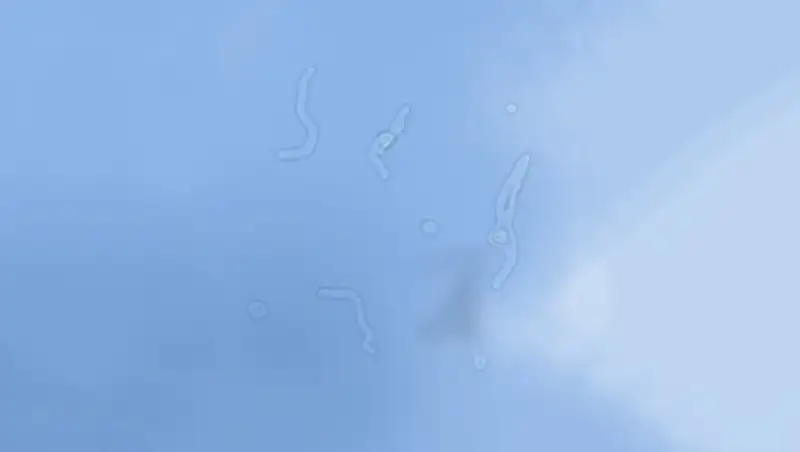 Почему мы видим "плавающие мушки" перед глазами