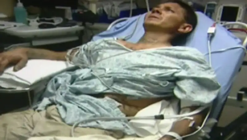 Американец попал в больницу после селфи с гремучей змеей