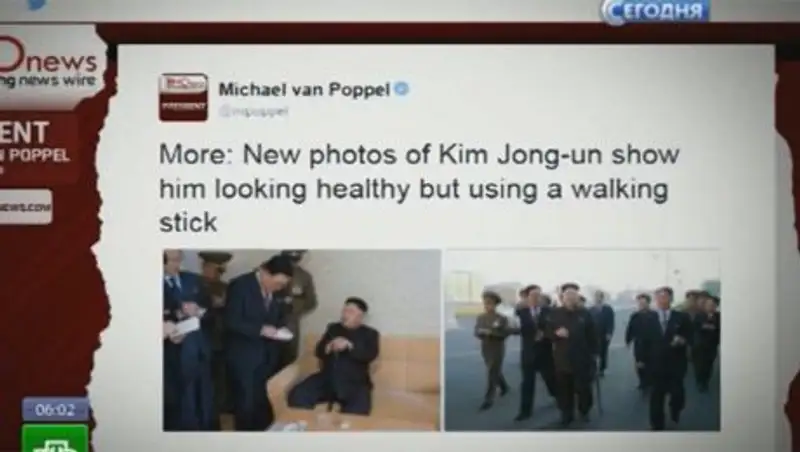 Снимки опирающегося на трость Ким Чен Ына произвели фурор в СМИ 