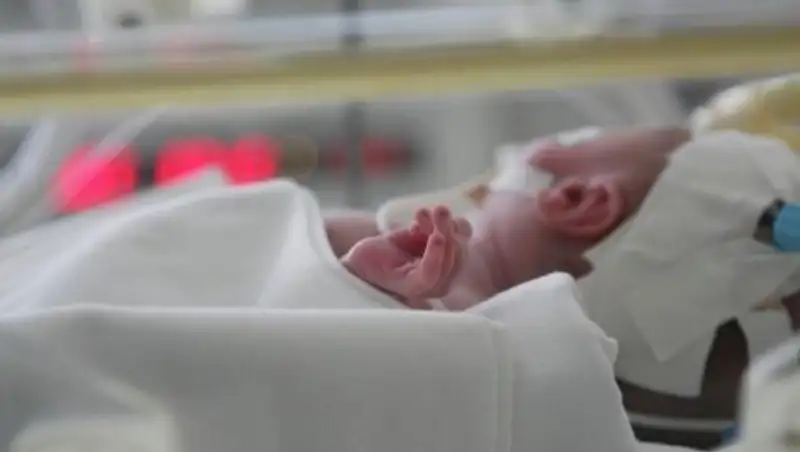 Доставленную из Таиланда в Алматы недоношенную девочку выхаживают врачи