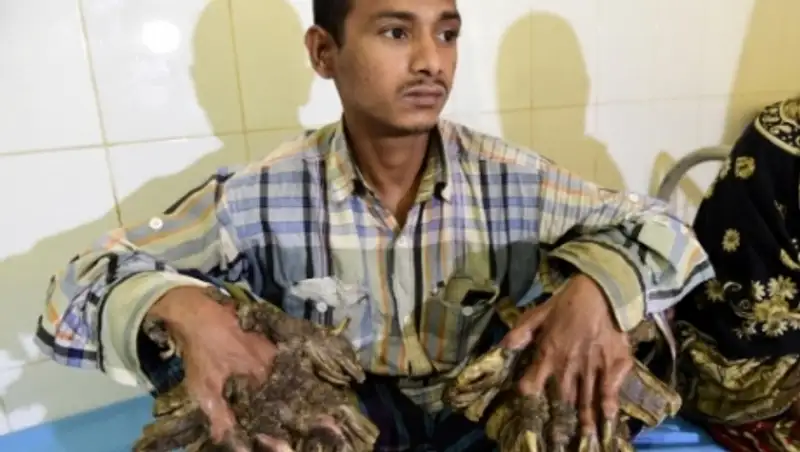 Бангладеште «а&#1171;аш адам&#1171;а» операция жасалды