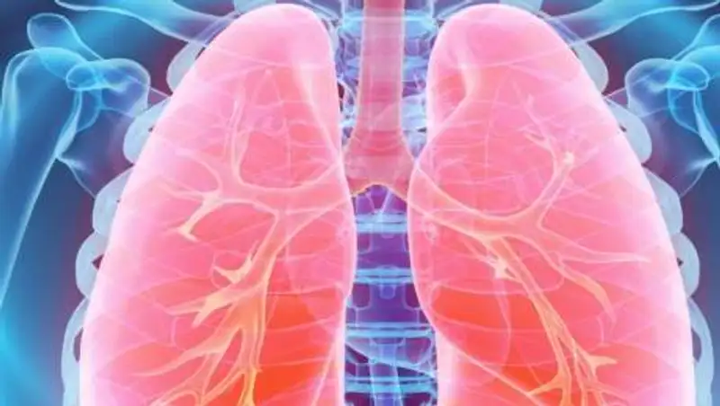 15 казахстанцев заболели пневмонией за сутки