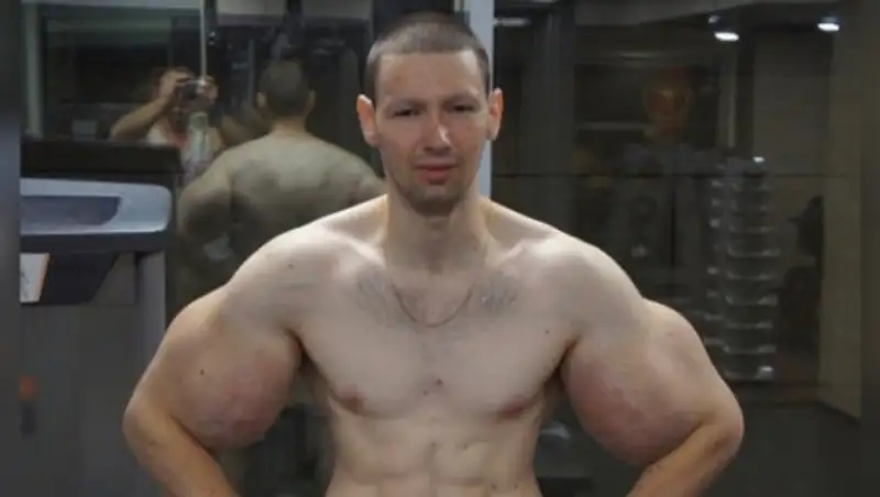 "Мама кормит с ложечки" Рукам-Базукам удалили синтол