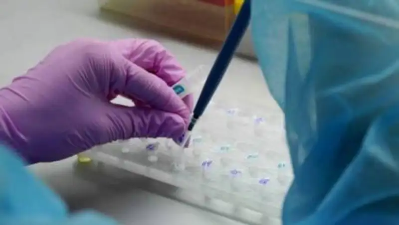 В апреле прогнозируют 20 тысяч заболевших COVID-19