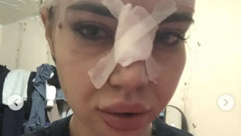 Карагандинку затоптали во время ЧП в ночном клубе