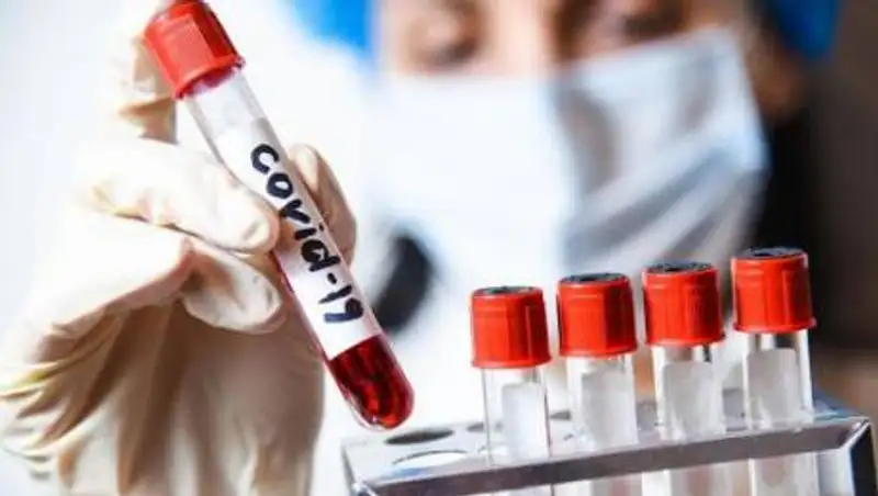 В Казахстане резко возросло число новых случаев COVID-19