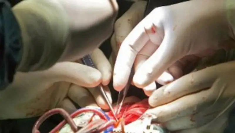 В Казахстане две дочери пожертвовали часть печени ради спасения своих мам