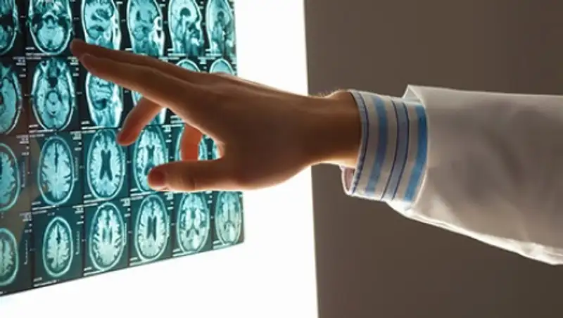 Психологи нашли разницу между мозгами технарей и гуманитариев